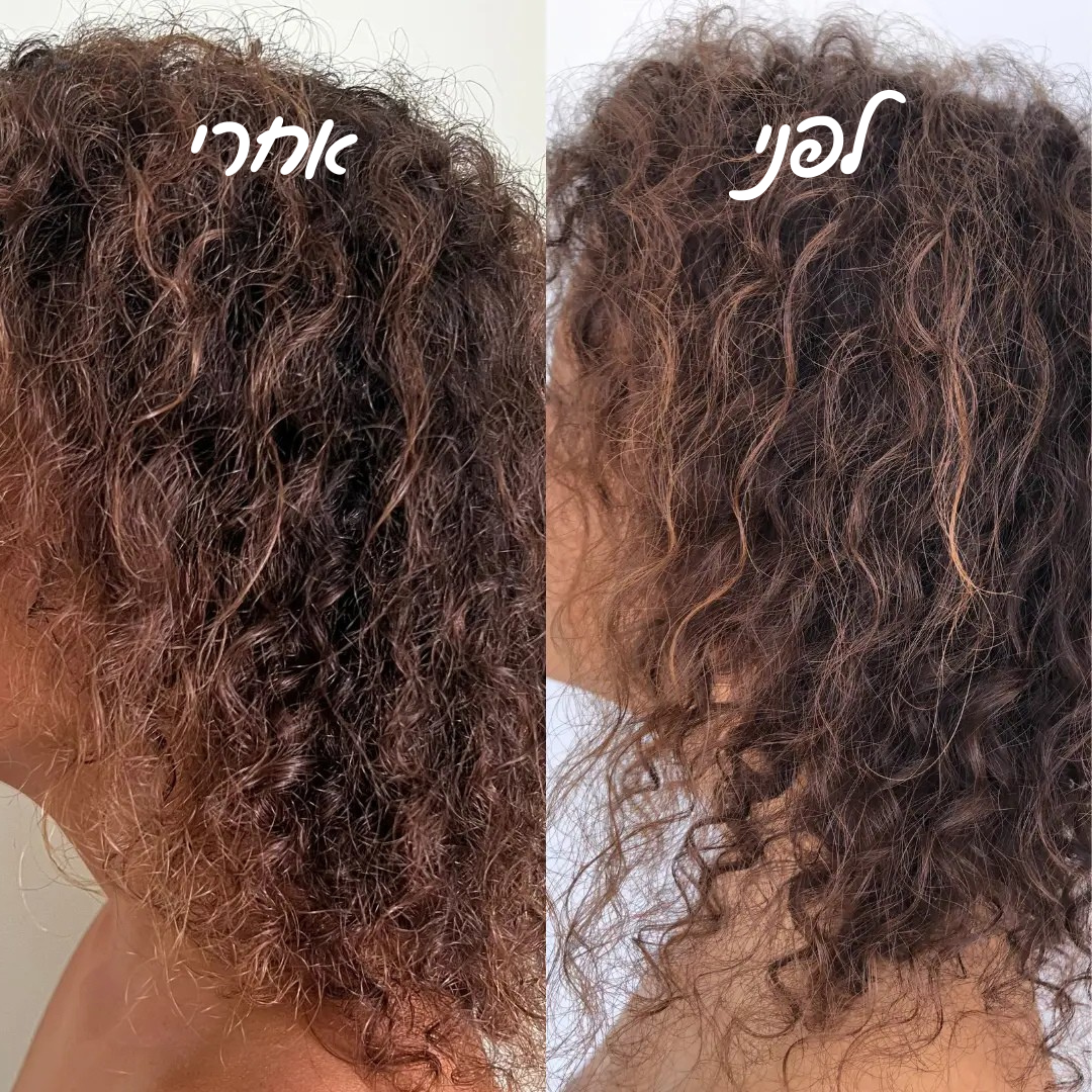 מארז שמפו ומרכך חלבון מי אורז להצמחת שיער & סבון חמאת שיאה