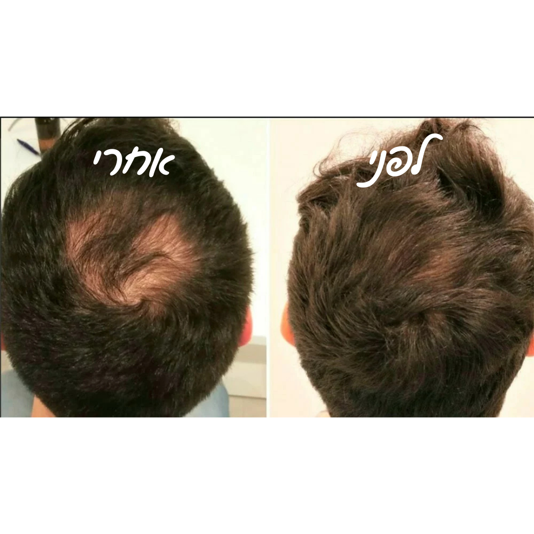מארז שמפו ומרכך מחלב אורז להצמחת שיער & סבון חמאת שיאה