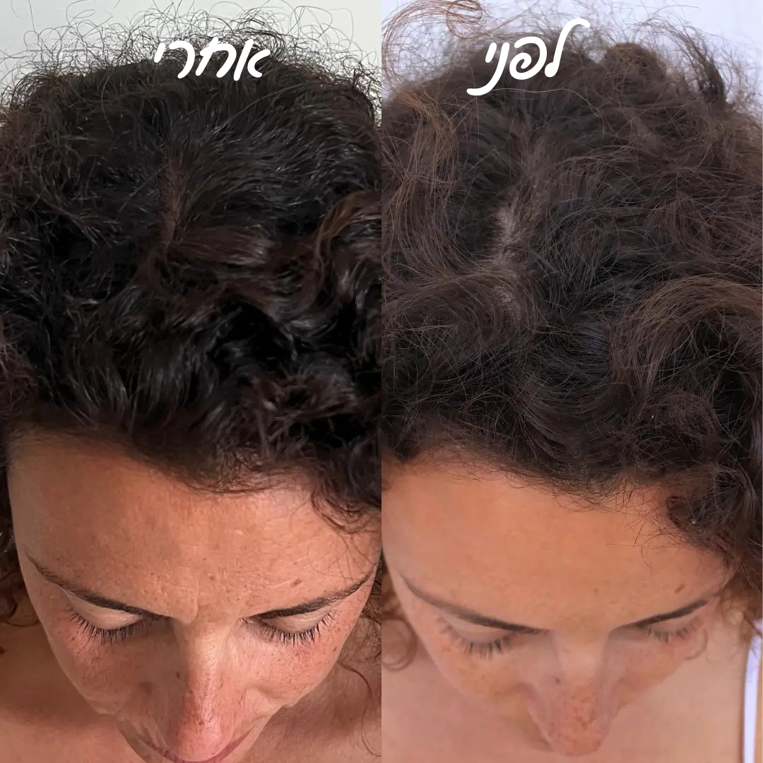 מארז שמפו ומרכך רוזמרין וביוטין לנפח וחיזוק השיער & סבון חמאת שיאה