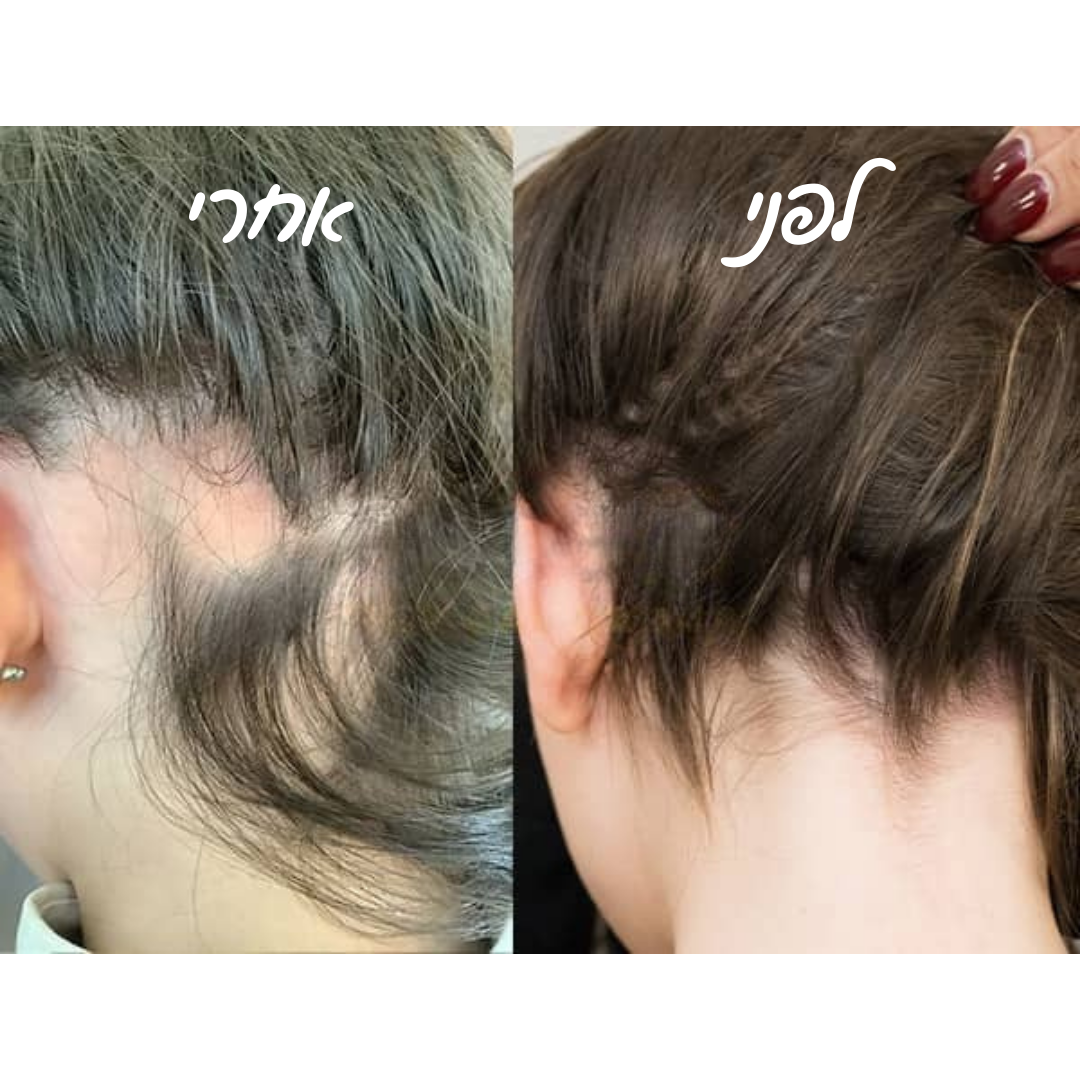 מארז שמפו ומרכך מחלב אורז להצמחת שיער & סבון חמאת שיאה