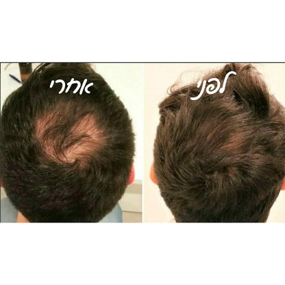 מארז שמפו ומרכך מחלב אורז להצמחת שיער & סבון חמאת שיאה